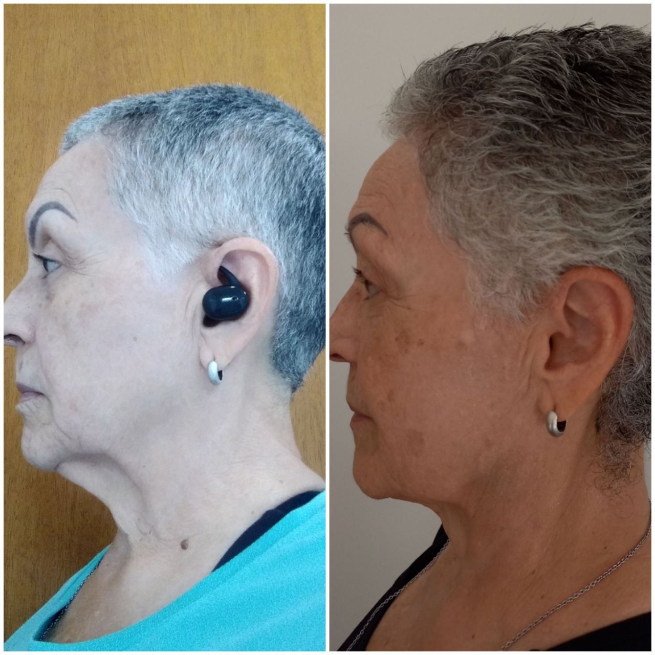 Depoimento antes e depois 1